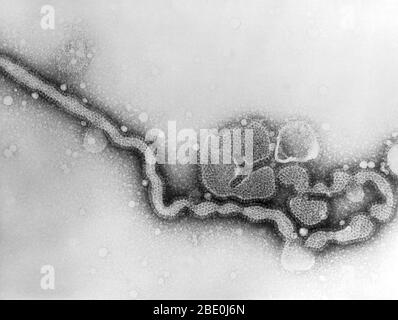 Micrographe électronique de transmission (TEM) du virus de l'influenza C. Banque D'Images