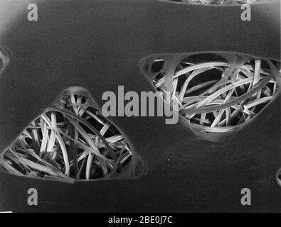 Tampon absorbant pour aides à la bande, vu sous un microscope électronique à balayage. La couche grise sans fonction est le film non absorbant qui empêche le tampon de coller à une plaie. Les brins de fil convolués visibles dans les trous sont les fibres qui rendent l'absorbant du tampon d'aide à la bande. Le côté long de chaque trou triangulaire mesure environ 400 microns de longueur, soit environ la longueur d'un grain de sel de table. (agrandissement 350 fois). Banque D'Images