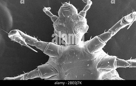 Il s'agit de l'une des images micrographiques électroniques à balayage (SEM) successivement agrandies à des valeurs supérieures et supérieures, qui focalisent sur la région de tête d'une serre de corps femelle, Pediculus humanus var. Corporis d'un point de vue ventral. À un grossissement relativement faible, ce mes révèle une partie de la morphologie exosquelosquelque de l'insecte, exposée par sa région céphalique, ou tête, thoracique et proximale régions abdominales. La configuration articulée de ses six extrémités, dont elle dérive sa classification dans le phylum d'Athropoda (c'est-à-dire Arthro de 'joint', et poda de 'leg'), est d'intérêt. Banque D'Images