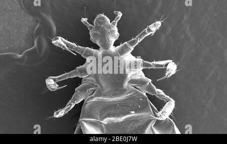 Il s'agit de l'une des images micrographiques électroniques à balayage (SEM) successivement agrandies à des valeurs supérieures et supérieures, qui focalisent sur la région de tête d'une serre de corps femelle, Pediculus humanus var. Corporis d'un point de vue ventral. À un grossissement relativement faible, ce mes révèle une partie de la morphologie exosquelosquelque de l'insecte, exposée par sa région céphalique, ou tête, thoracique et proximale régions abdominales. La configuration articulée de ses six extrémités, dont elle dérive sa classification dans le phylum d'Athropoda (c'est-à-dire Arthro de 'joint', et poda de 'leg'), est d'intérêt. Banque D'Images