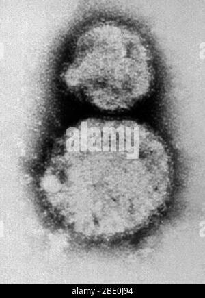 Le micrographe électronique à transmission colorée négative (TEM) décrit les virions du virus Sin Nombre (SNV), qui sont membres du genre Hantavirus, au sein de la famille des Bunyaviridae. Le virus Sin Nombre est la cause du syndrome cardioppulmonaire de l'hantavirus (HCP), également appelé syndrome pulmonaire de l'hantavirus (HPS), chez l'homme. En novembre 1993, le hantavirus spécifique à l'origine de l'éclosion des quatre coins a été isolé. Utilisant des tissus d'une souris de cerf qui avait été piégée près de la maison du Nouveau-Mexique d'une personne qui avait eu la maladie, la branche des agents pathogènes spéciaux de CDC a augmenté le virus en laboratoire Banque D'Images