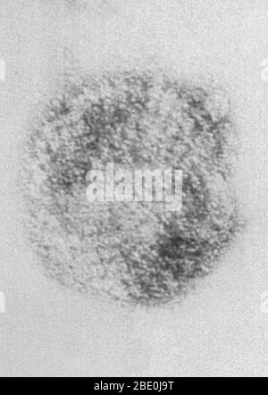 Le micrographe électronique à transmission colorée négative (TEM) décrit les virions du virus Sin Nombre (SNV), qui sont membres du genre Hantavirus, au sein de la famille des Bunyaviridae. Le virus Sin Nombre est la cause du syndrome cardioppulmonaire de l'hantavirus (HCP), également appelé syndrome pulmonaire de l'hantavirus (HPS), chez l'homme. En novembre 1993, le hantavirus spécifique à l'origine de l'éclosion des quatre coins a été isolé. Utilisant des tissus d'une souris de cerf qui avait été piégée près de la maison du Nouveau-Mexique d'une personne qui avait eu la maladie, la branche des agents pathogènes spéciaux de CDC a augmenté le virus en laboratoire Banque D'Images