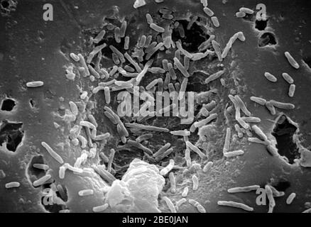 Balayage du micrographe électronique (SEM) de Mycobacterium chelonae, un type de bactérie liée à celle qui cause la tuberculose, et qui est généralement présent dans le sol et parfois dans l'expectoration. Mycobacterium chelonae est une espèce d'actinobactéries phylum (bactéries Gram-positives à forte teneur en guanine et en cytosine, l'une des phyles dominantes de toutes les bactéries) appartenant au genre mycobacterium. M. chélonae est une mycobactérie à croissance rapide, qui se trouve dans tout l'environnement, y compris les eaux usées et l'eau du robinet. M. chélonae peut provoquer des infections postopératoires de la plaie dans les tissus mous et les os Banque D'Images