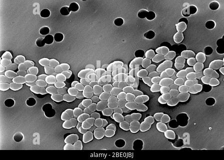 Micrographe électronique à balayage (SEM) d'entérocoques résistants à la vancomycine (ERV). En France, des souches de la bactérie, Enterocoques, résistantes à l'antibiotique vancomycine, connue sous le nom d'entérocoques résistants à la vancomycine, ont été trouvées en 1986. La maladie due aux infections d'ERV chez les personnes en bonne santé est rare. Les infections courantes causées par les entérocoques sont les intions des voies urinaires et les infections des plaies. Banque D'Images