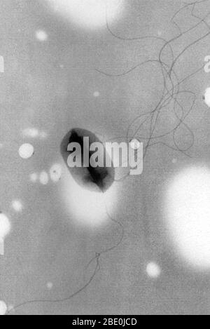 Micrographe électronique de transmission (TEM) d'Escherichia coli (E. coli) O157:H7 montrant la flagelle (technique de pseudoreplica). La bactérie est une cause connue de maladie d'origine alimentaire. La souche d'E. coli, l'E157: , a été reconnue pour la première fois en 1982 lors d'une éclosion de diarrhée grave causée par des hamburgers contaminés. L'infection peut être évitée en s'assurant que la viande est bien cuite. Escherichia coli est une bactérie coliformes, anaérobique, en forme de tige, à Gram négatif, du genre Escherichia, qui se trouve généralement dans l'intestin inférieur des organismes à sang chaud (endothermes). Magni Banque D'Images
