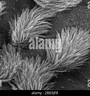 L'analyse des électrons Microphotographie (SEM) de l'épithélium de la trachée respiratoire. Il y a à la fois et non ciliées cellules ciliées dans cet épithélium. Notez la différence de taille entre les cils et les microvillosités (sur la surface des cellules ciliées non). Grossissement : 5000x. Banque D'Images