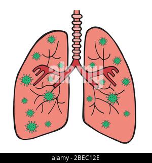 Illustration vectorielle dessinée à la main du virus Wuhan corona, covid-19. Virus dans les poumons. Illustration de Vecteur