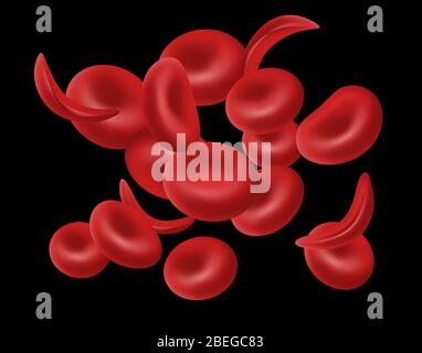 Les Drépanocytes, illustration Banque D'Images