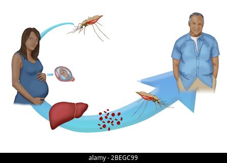 Une version simplifiée du cycle du paludisme. Le paludisme est une maladie à transmission vectorielle transmise par la piqûre de moustique d'Anopheles. Le paludisme peut également être transmis à un nourrisson pendant la naissance si la mère est infectée. Les moustiques acquièrent le parasite du paludisme en mordant une personne ou un animal infecté. Banque D'Images