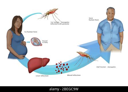 Cycle du paludisme, illustration Banque D'Images