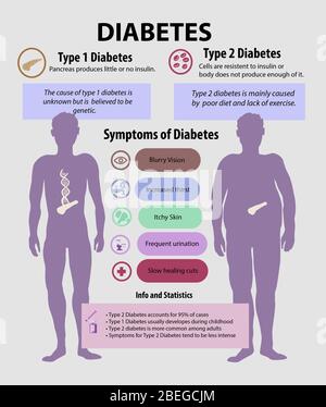Infographie décrivant les types de diabète, leurs symptômes et d'autres faits sur la maladie. Banque D'Images