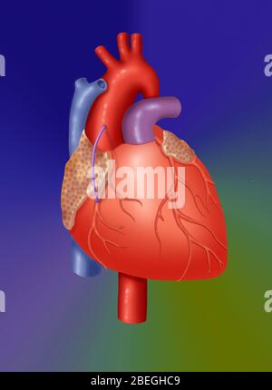 Radeau de veine coronaire Banque D'Images