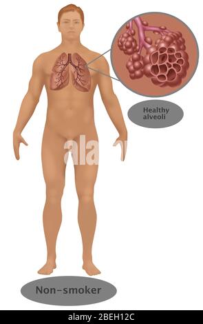 Poumons et alvéoles d'un non fumeur Banque D'Images