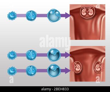 Développement de Twins, Illustration Banque D'Images