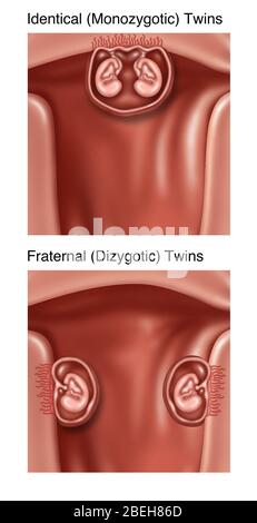 Développement de Twins, Illustration Banque D'Images