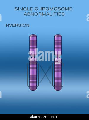 Inversion chromosomique, illustration Banque D'Images