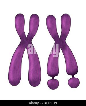 Chromosome X fragile, Illustration Banque D'Images
