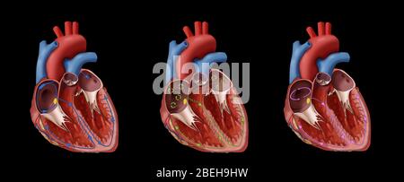 Coeur, Fib et Flutter auriculaire, Illustration Banque D'Images