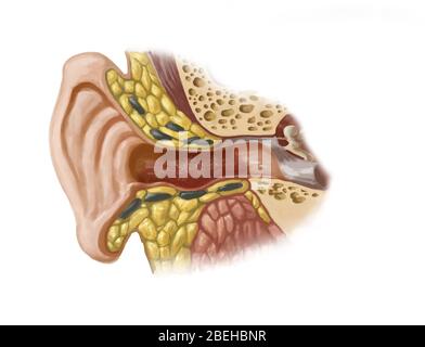 Oreille du nageur, illustration Banque D'Images