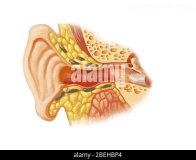 Oreille du nageur, illustration Banque D'Images