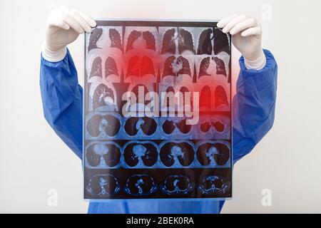 Les poumons sont numérisés dans les mains du médecin. Chirurgien en uniforme de protection, vérifier le film radiographique. Coronavirus Covid 19, pneumonie, tuberculose, cancer du poumon, respiratoire Banque D'Images