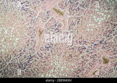 Hémosidérose foie 100 fois sous microscope Banque D'Images