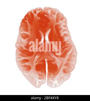 Vue de dessus coupe de cerveau isolée sur fond blanc. Concept pour les maladies neurologiques, les tumeurs et la chirurgie cérébrale Banque D'Images