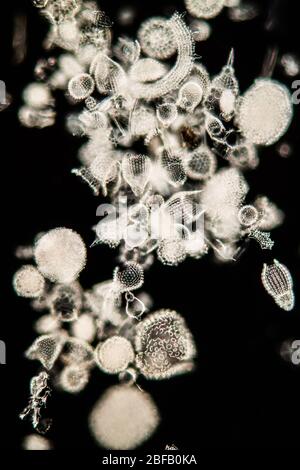 Radiolaria animaux marins sous le microscope 100 fois Banque D'Images