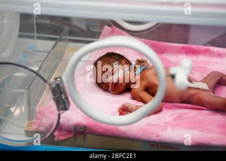 Bébé prématuré dans un incubateur de l'unité néonatale d'un hôpital. Les bébés prématurés sont placés dans l'incubateur car ils n'ont pas complètement développé la mécha Banque D'Images