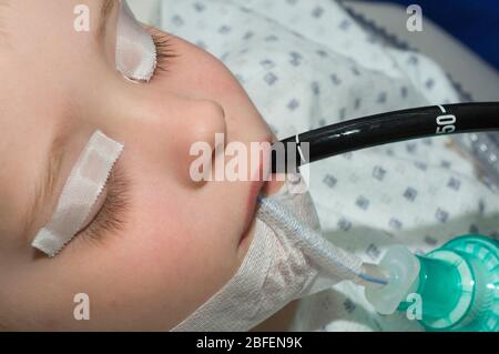 Jeune enfant en examen endoscopique. Banque D'Images