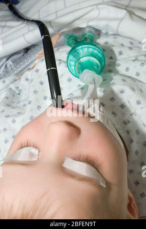 Jeune enfant en examen endoscopique. Banque D'Images