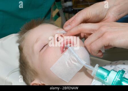 Jeune enfant portant un tube de trachéostomie pendant l'utilisation Banque D'Images