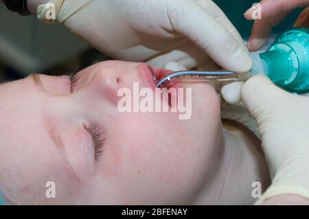 Jeune enfant portant un tube de trachéostomie pendant l'utilisation Banque D'Images