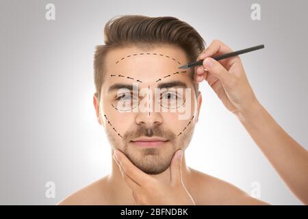 Surgeon marques sur homme face contre un arrière-plan gris. Concept de chirurgie plastique Banque D'Images