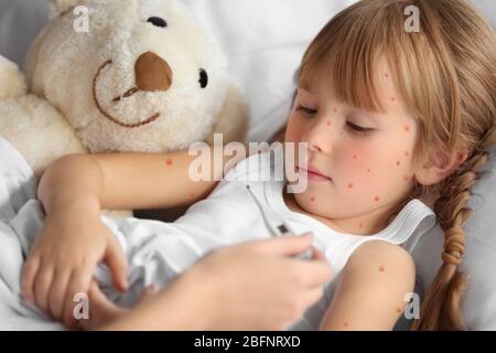 Mère mesurant la température de la petite fille avec des boutons rouges. Concept de varicelle Banque D'Images