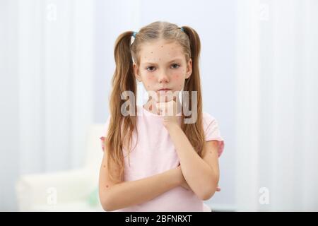 Petite fille avec boutons rouges à la maison. Concept de varicelle Banque D'Images