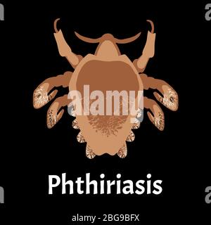Maladies parasitaires de la phthiriase. Pubis de pédiculose. Structure des poux pubiens. Maladies sexuellement transmissibles. Infographies. Illustration vectorielle activée Illustration de Vecteur