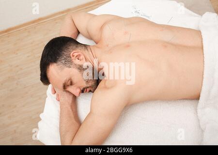 Le patient de l'homme se détend de la procédure d'acupuncture. Acupuncturiste faisant de l'acupuncture très précisément. Médecine chinoise traditionnelle Banque D'Images