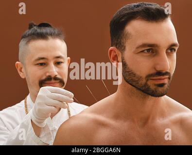 Acupuncturist insère l'aiguille d'acupuncture dans l'épaule d'un homme qui le guérit d'une maladie. Traitement d'acupuncture des maladies. Banque D'Images