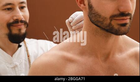 Aiguilles pour l'acupuncture dans l'épaule d'un homme gros plan sur un fond brun. Un réflexologue faisant très précisément de l'acupuncture Banque D'Images