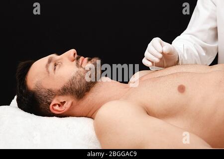 Acupuncturist insère des aiguilles d'acupuncture à des points spéciaux sur les méridiens du corps d'un homme. Aiguilles d'acupuncture dans la main réflexologue gros plan sur bl Banque D'Images