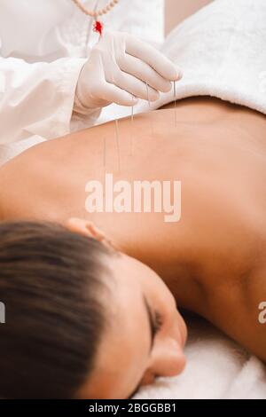 Traitement du système musculo-squelettique d'une femme par une procédure d'acupuncture dans une clinique. Aiguilles le long de la colonne vertébrale d'une femme de près Banque D'Images