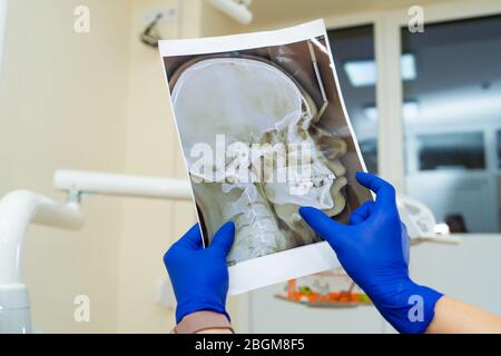 Vue de la première personne. Le médecin dentiste professionnel regarde la radiographie de la mâchoire du patient. Banque D'Images