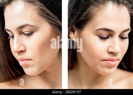 Portrait de la femme en comparant ses yeux avant et après l'extension de la paupière. Banque D'Images