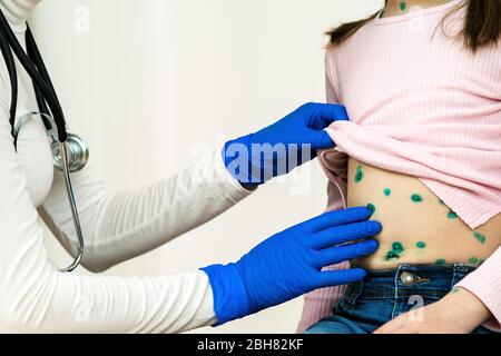 Médecin examinant un enfant couvert de éruptions vertes sur l'estomac malade avec la varicelle, la rougeole ou la rubéole. Banque D'Images