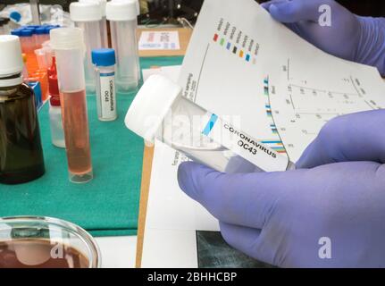 Scientifique étudie les courbes de la pandémie Covic-19 et l'adn d'une personne infectée, tenant un flacon d'échantillon dans un hôpital, en Espagne, image conceptuelle Banque D'Images