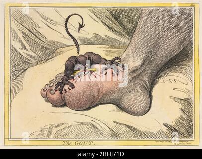 Le Gout 1799 de James Gillray (britannique, 1757-1815) publié par Hannah Humphrey Angleterre, XVIIIe siècle Etching couleur à la main avec aquarelle sur papier de vélin. Une figure de diable est montré mordant dans des articulations douloureuses et enflammées de l'orteil. Le gout est une condition métabolique où les cristaux d'acide urique sont déposés dans les articulations, causant une grande douleur. Le gros orteil est le joint le plus souvent affecté. Les principales causes sont les facteurs génétiques et le régime alimentaire. Banque D'Images