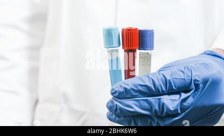 Testez les tubes de flacons dans les mains d'un médecin avec des gants en latex. Test médical pour le vaccin contre le coronavirus. Banque D'Images