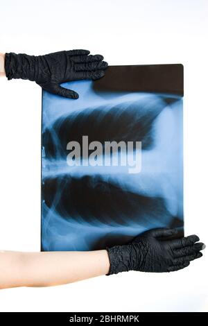 Radiographie des poumons humains dans les mains en gants noirs, gros plan. Concept de maladie du coronavirus Covid-19. Assurance en cas de pandémie, maladies aéroportées. Grille. Banque D'Images