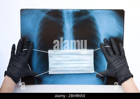 Masque respiratoire bleu sur les rayons X des poumons humains dans les mains en gants noirs, gros plan. Concept de maladie du coronavirus Covid-19. Assurance en cas de pandémie, vol d Banque D'Images